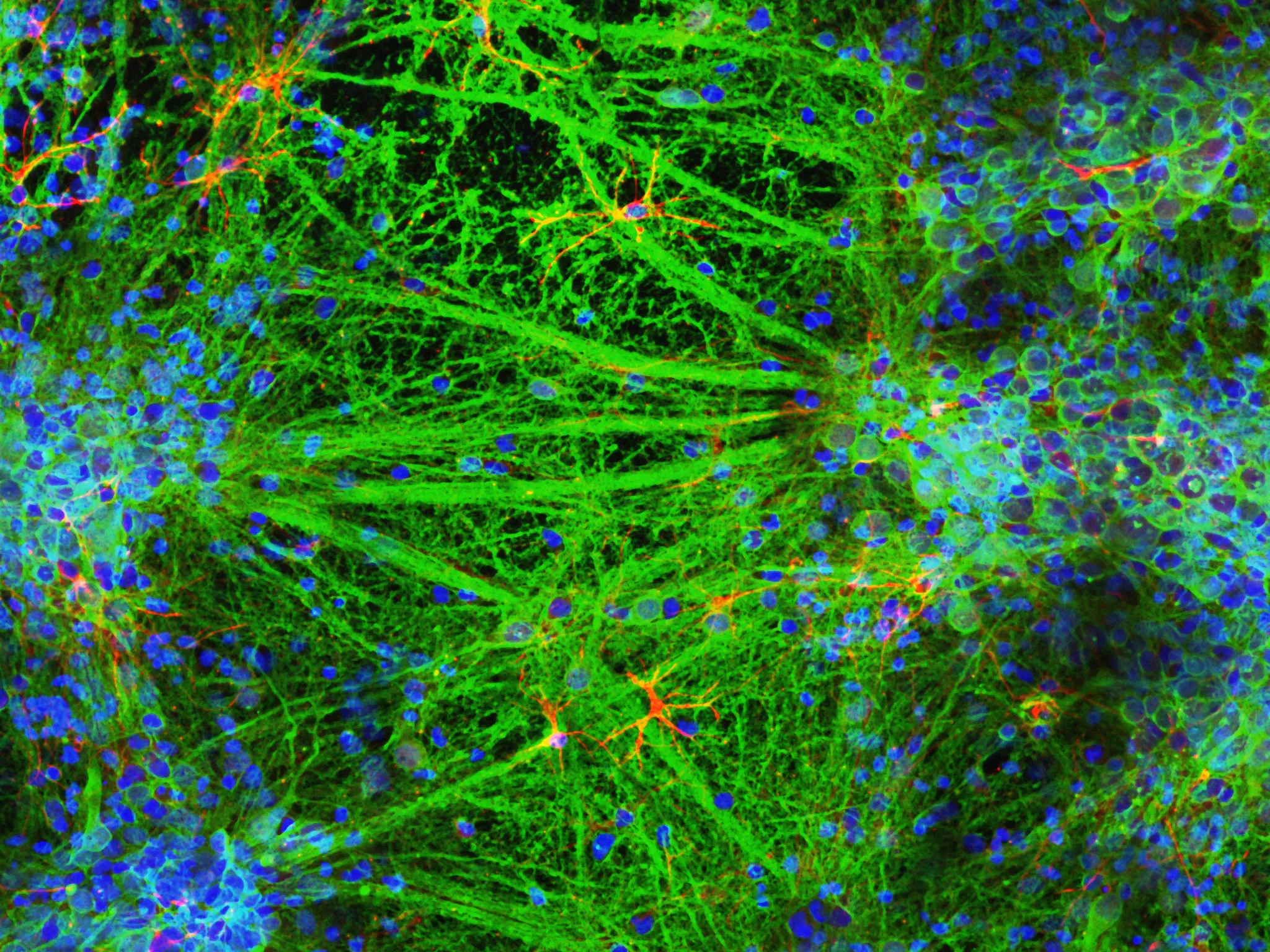 3D-Printed Stem Cells: A Potential Breakthrough for Brain Injuries